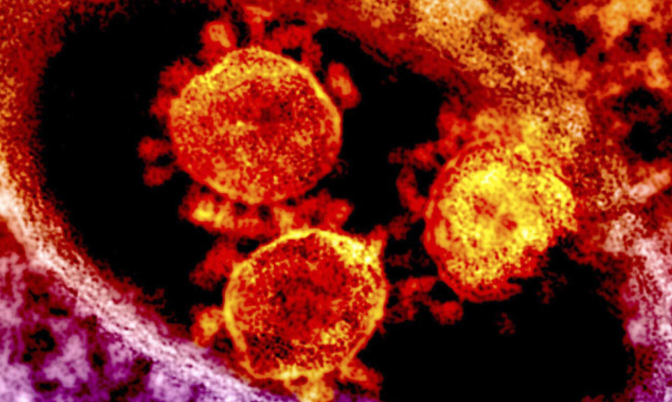 Current Fear-Based MERS Narrative Omits Significant Impact of Comorbidities