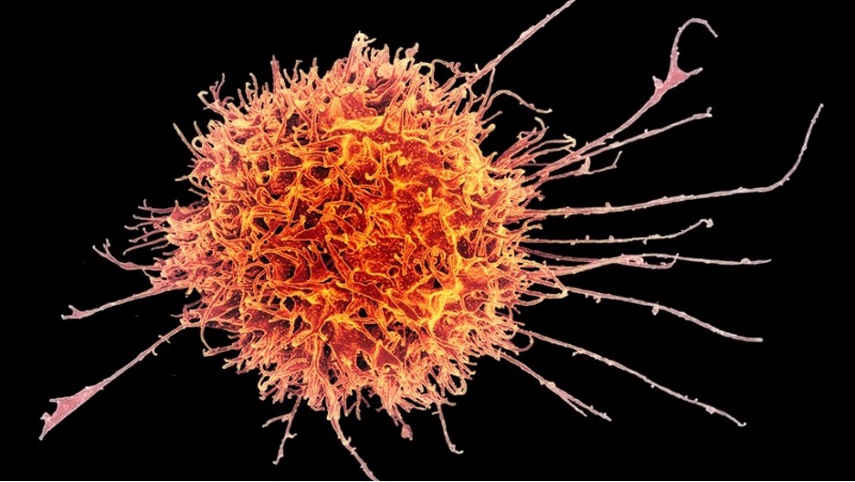 The Non-Infectious Pandemic: The Spike Protein Puts The Body's Natural Killer Cell To Sleep - The HighWire