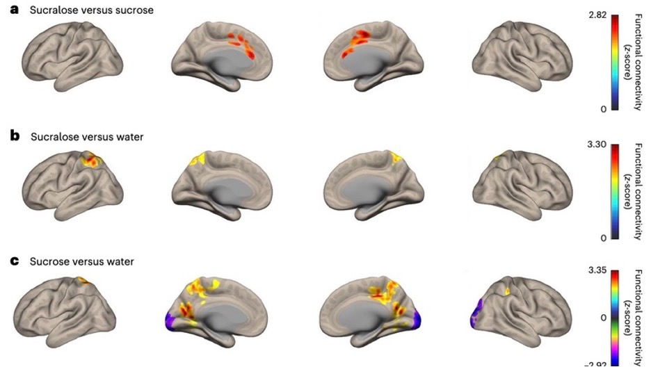 Sucralose Causes Brain Changes that Increase Appetite - The HighWire